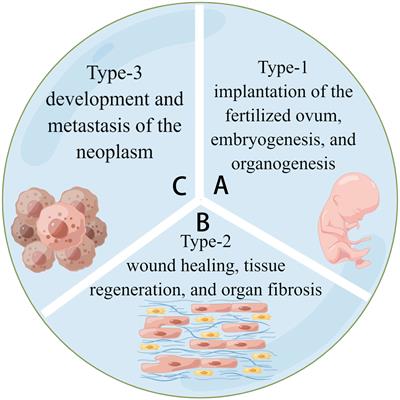 Type-2 epithelial-mesenchymal transition in oral mucosal nonneoplastic diseases